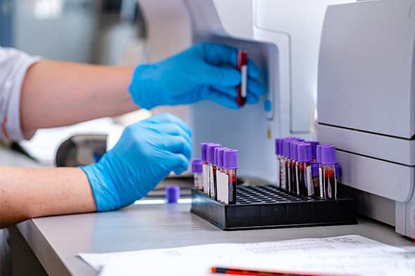 Molecular Status for the Discontinuation of Tyrosine Kinase Inhibitor Therapy