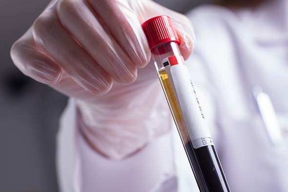 Noninvasive Tests to Risk Stratify Patients With Fatty Liver Disease