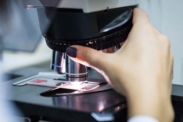 Liquid Versus Tissue Biopsies in Advanced Pancreatic Cancer