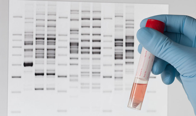 Role of Genetics, Immunology, and Biomarkers in Metastatic Pancreatic Cancer