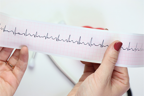 Cardiovascular Risk in Patients With Psoriasis