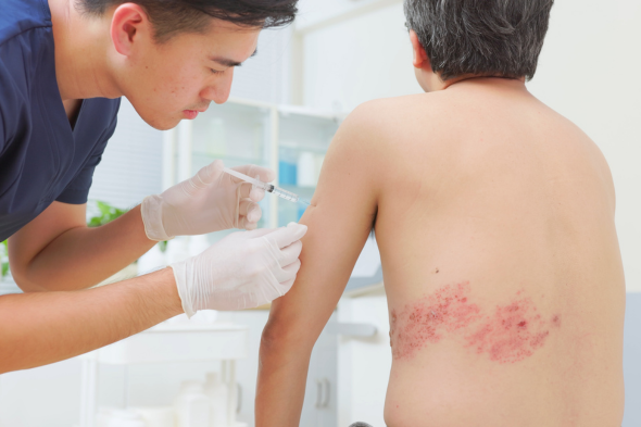 Systemic Therapy for Adults With Atopic Dermatitis