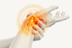 Emerging Therapies and Targets in Rheumatoid Arthritis