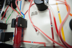 Autologous Stem Cell Transplantation for Mantle Cell Lymphoma in Different Treatment Settings