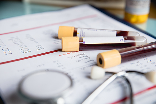 Imaging- and Blood-Based Markers of Hepatic Fibrosis and Cirrhosis