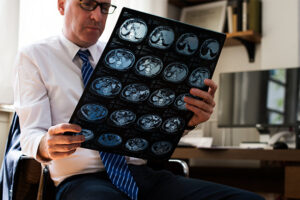 Elderly Patients With Multiple Sclerosis: Efficacy of Disease-Modifying Therapy