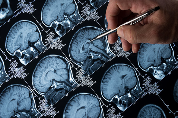 Detection and Monitoring of Multiple Sclerosis: Past, Present, and Future