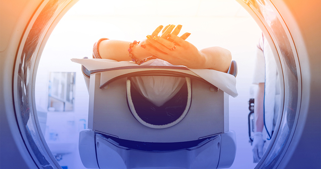 Role of Radiotherapy in the Treatment of Metastatic Pancreatic Cancer