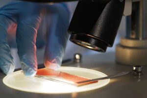 Risk Stratification and Current Challenges in Chronic Myeloid Leukemia