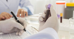 Biological and Clinical Predictive Factors of Response in Patients With Chronic Immune Thrombocytopenia