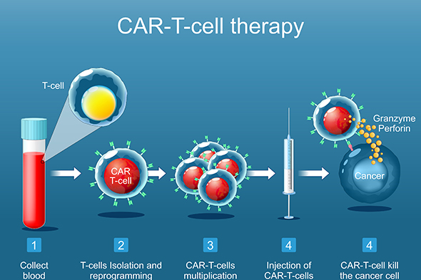 Chimeric Antigen Receptor T-Cell Therapy for Systemic Lupus Erythematosus