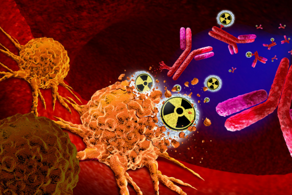 Radiopharmaceutical Therapy in Advanced Prostate Cancer